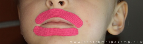 Centrum Neurologopedyczne Hipokamp